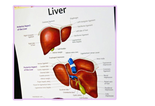 liver cancer